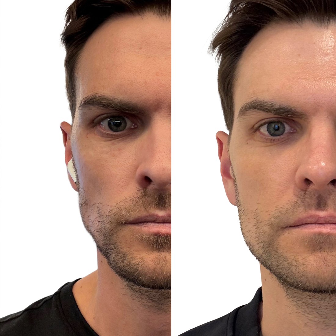 Before and after JULÄINE under eye treatment result