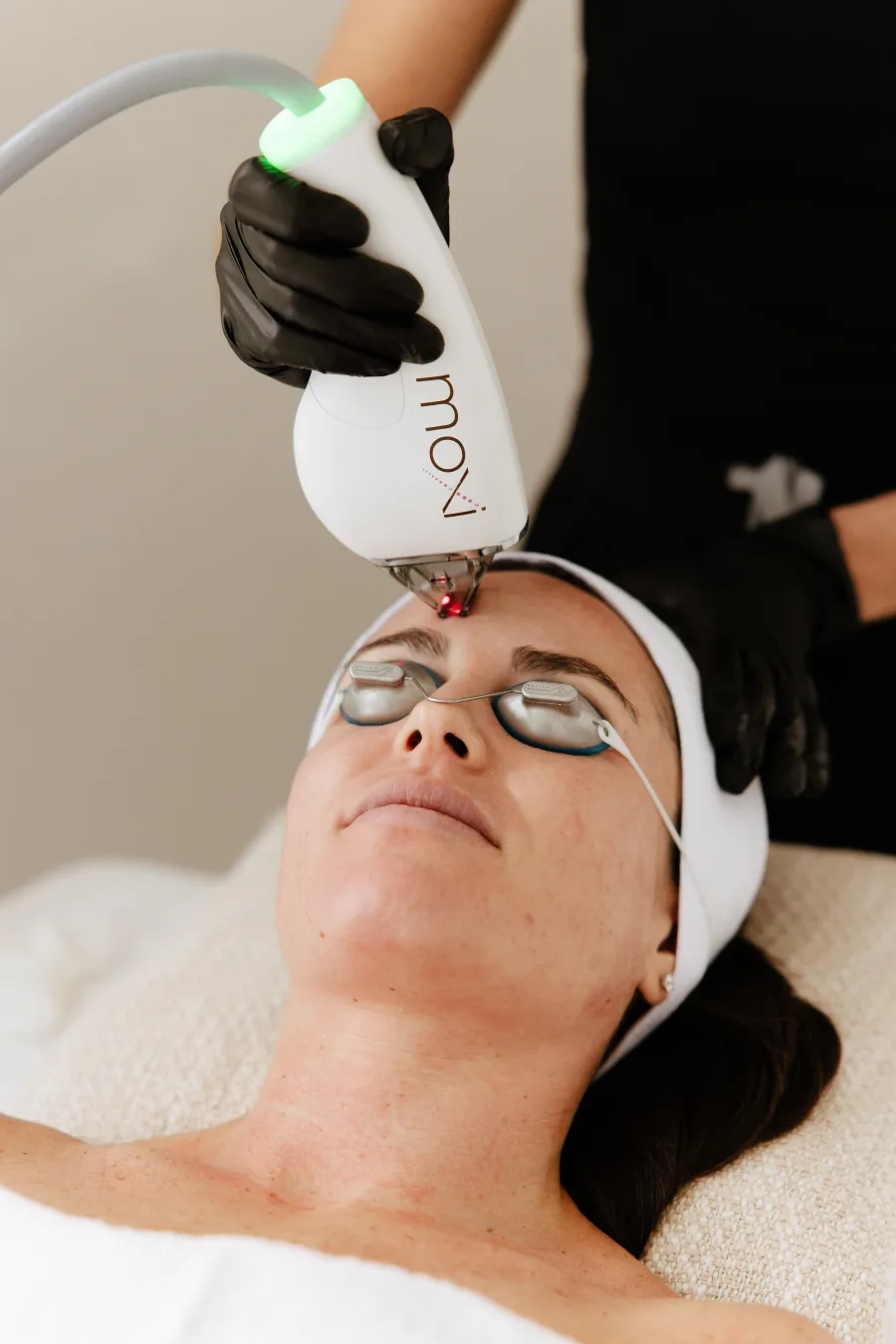 Moxi laser treatment landing page preview